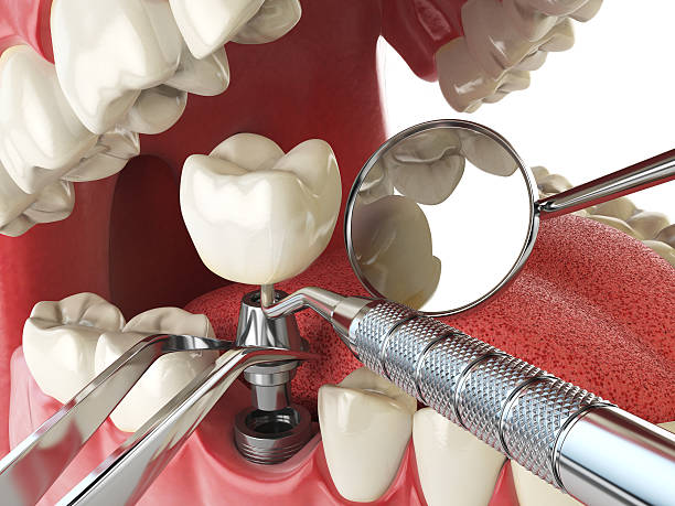 Best Emergency Care for Gum Disease in Bowdon, GA